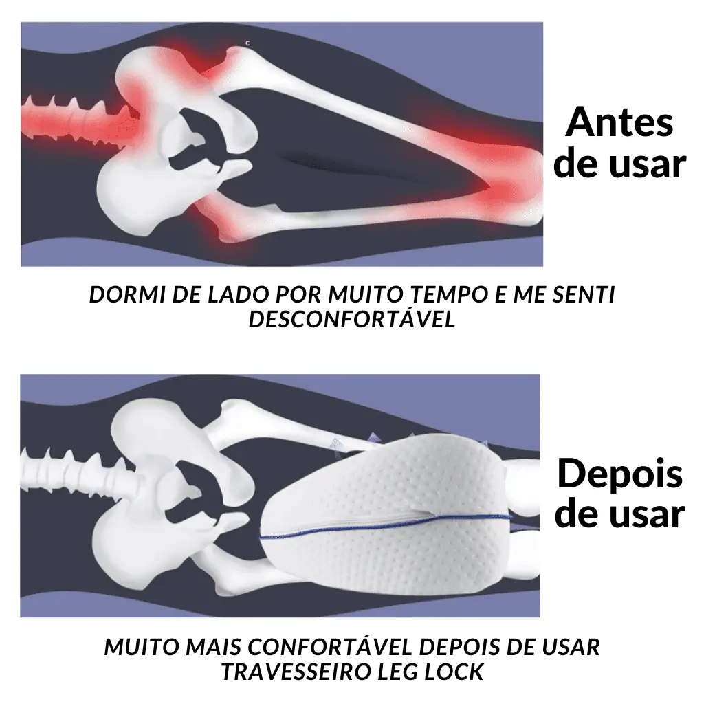 Almofada-Anatômica-Apoio-Postural-SonoLeve-comparação